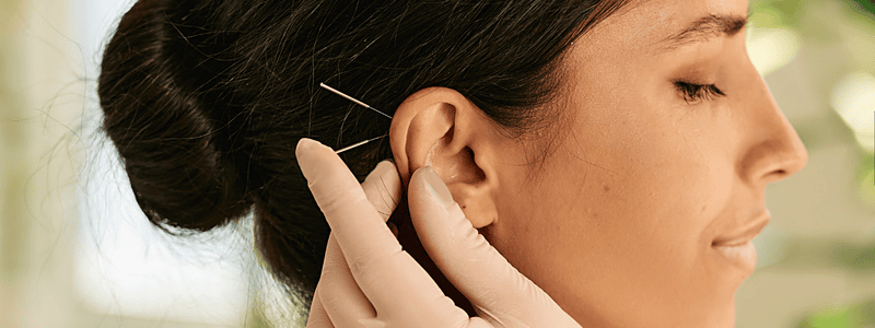 Εφαρμογή ωτοβελονισμού στο αυτί ασθενούς για διακοπή καπνίσματος