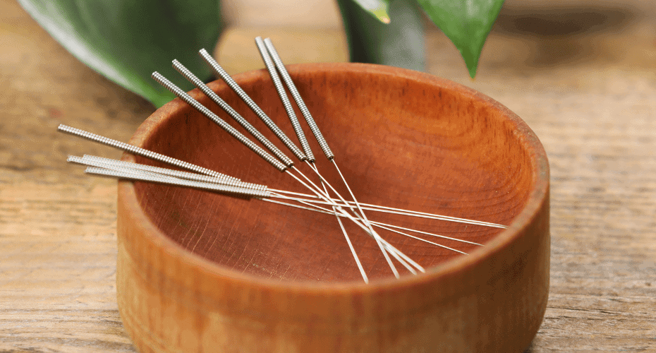 Είδη Βελονισμού. Βελόνες για ιατρικό βελονισμό για ασθενή με χρόνιο πόνο